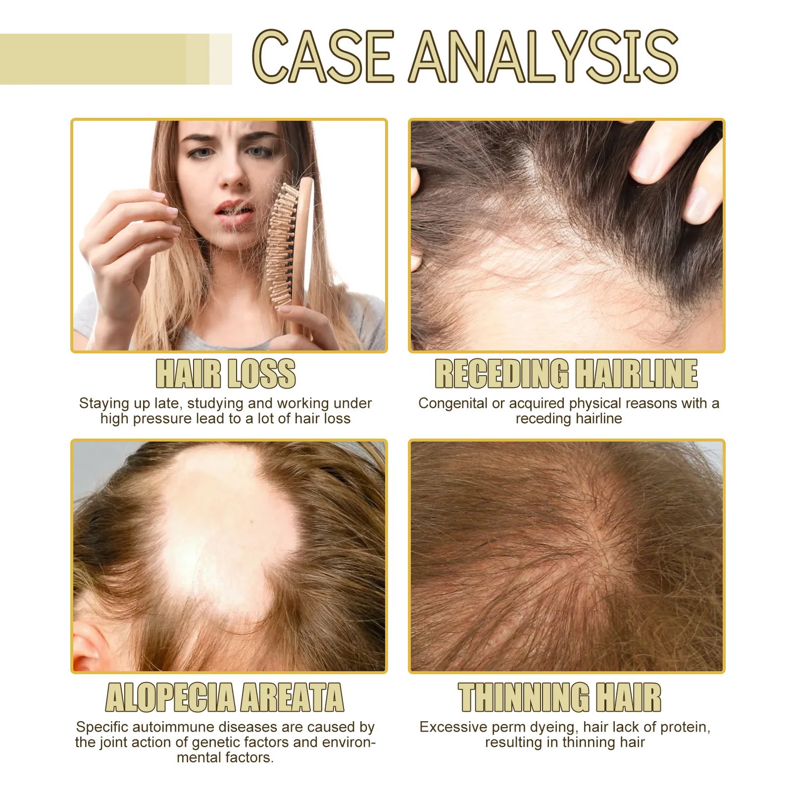 EELHOE Rosemary Oil Grows Hair Loss Treatment Bald Head Hair Regrowth Moisturizing Hair Scalp Massager Rosemary Essential Oil - Image 6