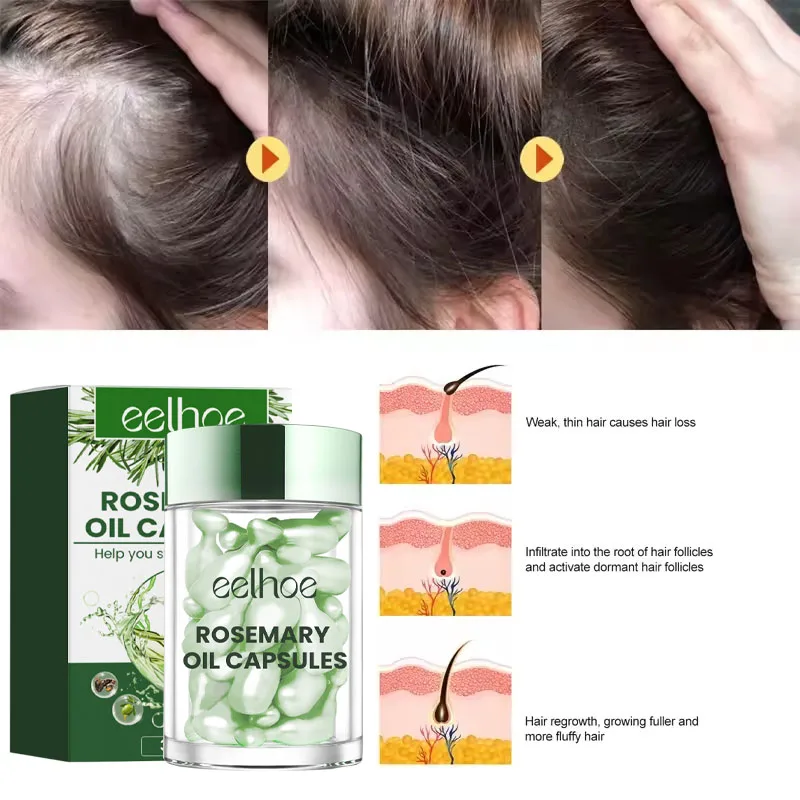 Hair Growth Products Anti Hair Loss Essential Oil Prevent Baldness Scalp Treatment Capsule Fast Regrowth Beauty Health Men Women - Image 4